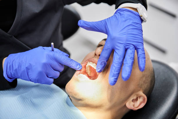 Best Emergency Root Canal Treatment in Golden Valley, MN
